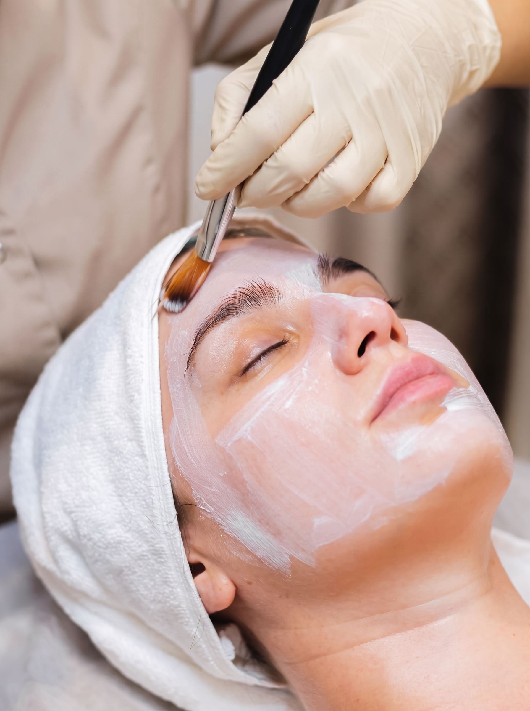 Chemical Peels