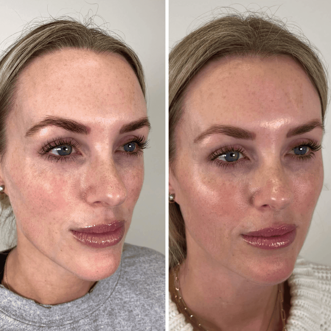 Tone, redness and glow, before and after
