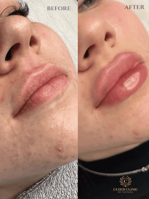 Volume and shape, before and after