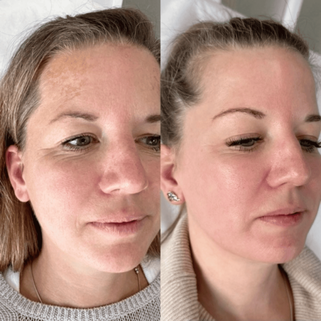 Tone, glow and lift, before and after